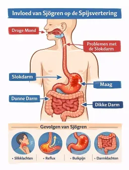 invloed van sjogren op spijsvertering invloed van sjogren op spijsvertering